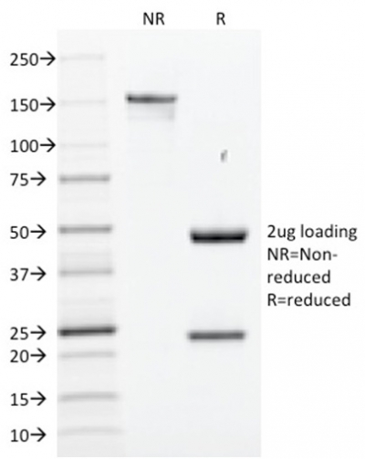 Data from SDS-PAGE analysis of Anti-SOX2 antibody (Clone SOX2/1791). Reducing lane (R) shows heavy and light chain fragments. NR lane shows intact antibody with expected MW of approximately 150 kDa. The data are consistent with a high purity, intact mAb.